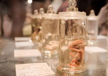 女性不孕不育主要有哪些原因？