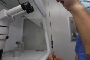 34岁单角子宫多大可以正常生育？