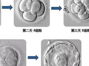 女性子宫肌瘤在武汉市妇女儿童医疗保健中心做三代试管预算八万块够不够？